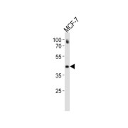 Estrogen Receptor Beta (ESR2) Antibody