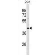 Opioid Binding Protein/cell Adhesion Molecule Like (OPCML) Antibody