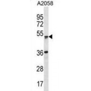 Zinc Finger And SCAN Domain-Containing Protein 21 (ZSCAN21) Antibody