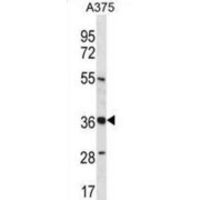 PIH1 Domain-Containing Protein 1 (PIH1D1) Antibody