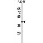 Ring Finger Protein 149 (RNF149) Antibody