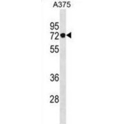 Podocan (PODN) Antibody