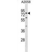 Synaptotagmin 16 (SYT16) Antibody