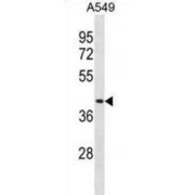 Dipeptidase 1 (Renal) (DPEP1) Antibody