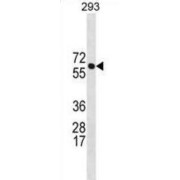 BRCA1-Associated Protein (BRAP) Antibody