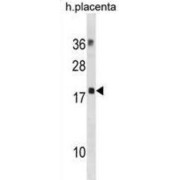 Myosin Light Chain 12B (MYL12B) Antibody