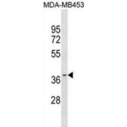 Olfactory Receptor 11A1 (OR11A1) Antibody