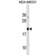 Galectin 7 (LGALS7) Antibody