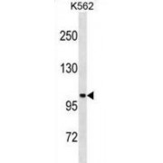 StAR-Related Lipid Transfer Protein 13 (STARD13) Antibody