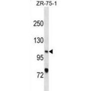 Xeroderma Pigmentosum, Complementation Group C (XPC) Antibody