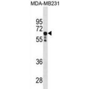 Serine/Threonine-Protein Phosphatase 2A 56 kDa Regulatory Subunit Alpha Isoform (PPP2R1A) Antibody