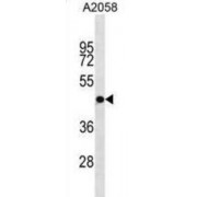 Olfactory Receptor 4S1 (OR4S1) Antibody