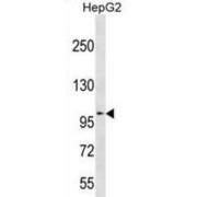 Alpha-Mannosidase 2C1 (MAN2C1) Antibody