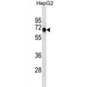 Ankyrin Repeat And Death Domain-Containing Protein 1A (ANKDD1A) Antibody