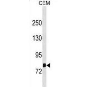 Olfactomedin Like 2B (OLFML2B) Antibody