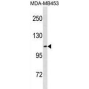 Ectonucleotide Pyrophosphatase/phosphodiesterase Family Member 3 (ENPP3) Antibody