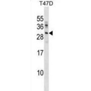 Ubiquitin-Conjugating Enzyme E2 R2 (UBE2R2) Antibody