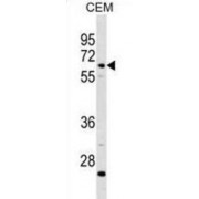 Complement Component 8, Beta Polypeptide (C8B) Antibody
