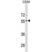 Bone Morphogenetic Protein 8A (BMP8A) Antibody