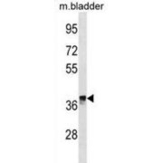 Ketimine Reductase Mu-Crystallin (CRYM) Antibody