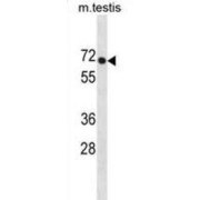 Phospholipase D3 (PLD3) Antibody