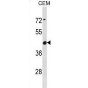 Zn Regulated GTPase Metalloprotein Activator 1F (ZNG1F) Antibody