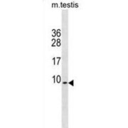 PDE6H Antibody