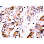 Huntington Disease Gene Regulatory Region-Binding Protein 2 (HDBP2) Antibody