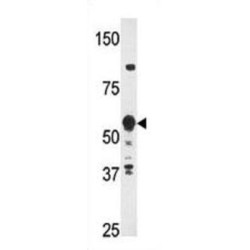 Huntington Disease Gene Regulatory Region-Binding Protein 2 (HDBP2) Antibody