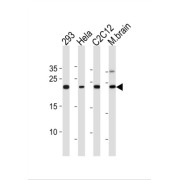 Ubiquitin-Conjugating Enzyme E2 K (UBE2K) Antibody