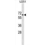 WB analysis of extracts of U251 cell line lysates (35 µg/lane), using GGT1 Antibody.