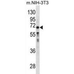 Glutathione Hydrolase 1 Proenzyme (GGT1) Antibody