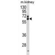 Eukaryotic Translation Initiation Factor 3 Subunit L (EIF3L) Antibody