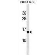 NADH Ubiquinone Oxidoreductase Subunit S6 (NDUFS6) Antibody