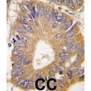 Eukaryotic Translation Initiation Factor 4E Binding Protein 1 (EIF4EBP1) Antibody