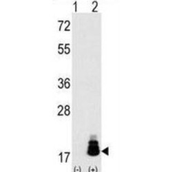 Eukaryotic Translation Initiation Factor 4E Binding Protein 1 (EIF4EBP1) Antibody