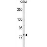 Methylenetetrahydrofolate Reductase (MTHFR) Antibody