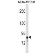 Nuclear Receptor Subfamily 3, Group C, Member 1 (Glucocorticoid Receptor) (NR3C1) Antibody