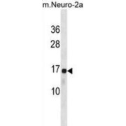 Ribosomal Protein L22 (RPL22) Antibody