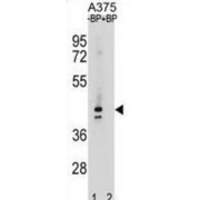 Olfactory Receptor 5AC2 (OR5AC2) Antibody