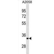 ELOVL Fatty Acid Elongase 3 (ELOVL3) Antibody