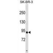 Dpy-19 Like C-Mannosyltransferase 3 (DPY19L3) Antibody