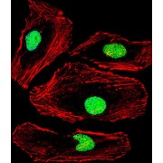 Methyl-CpG Binding Domain Protein 2 (MBD2) Antibody