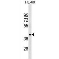 Methyl-CpG Binding Domain Protein 2 (MBD2) Antibody