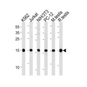 Ubiquitin-Conjugating Enzyme E2 L3 (UBE2L3) Antibody