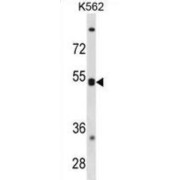 Chemokine C-X-C-Motif Receptor 5 (CXCR5) Antibody