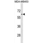 Alpha 1B Adrenergic Receptor (ADRA1B) Antibody