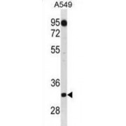 Complement C1q Tumor Necrosis Factor-Related Protein 2 (C1QTNF2) Antibody