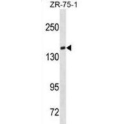 T-Cell Lymphoma Invasion And Metastasis Inducing Protein 1 (TIAM1) Antibody