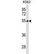 Testin (TES) Antibody